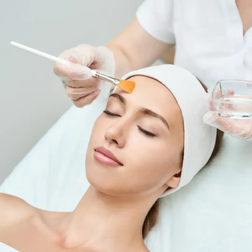 ChemicalPeels