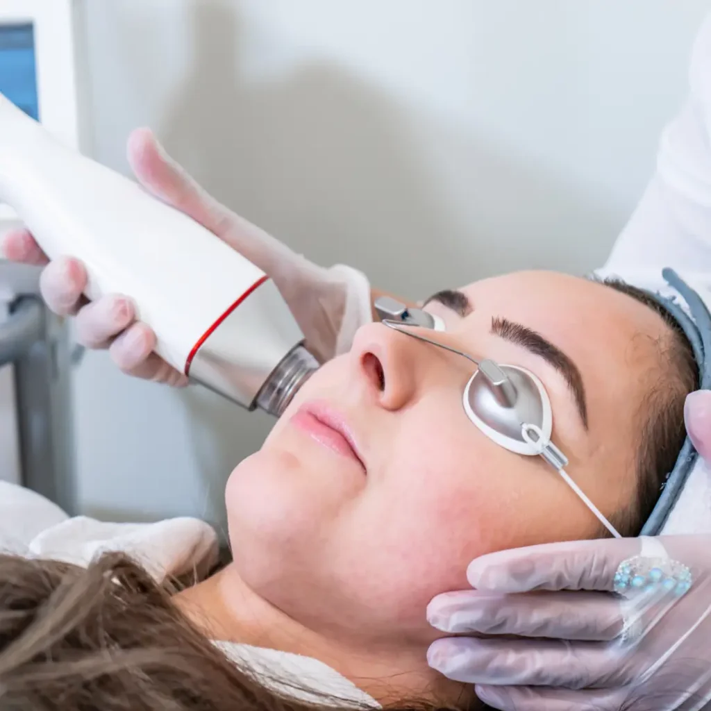 RFSkinTightening