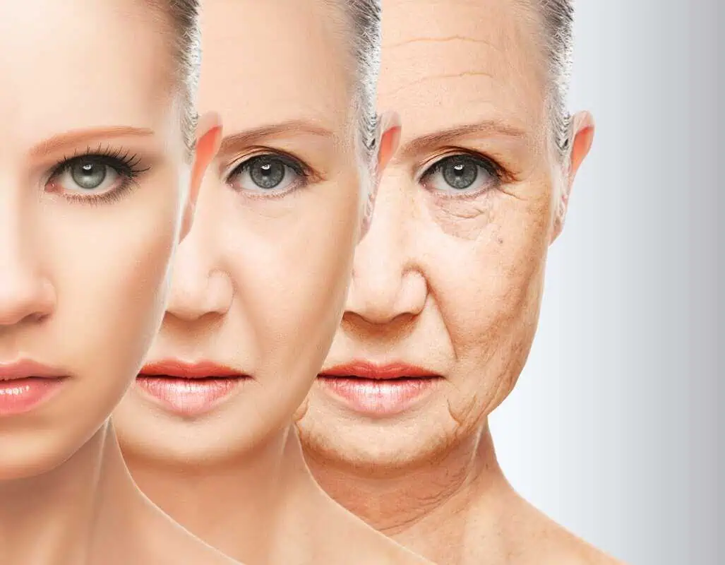 The Role of Collagen in Skin Tightening and How RF Treatments Boost It