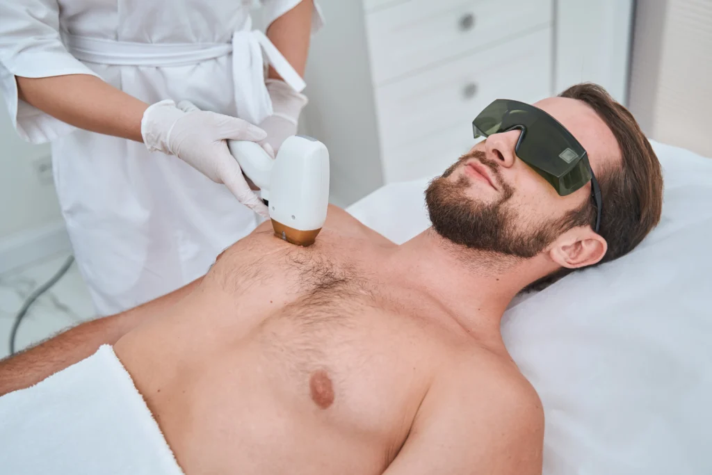 Laser Hair Removal for men